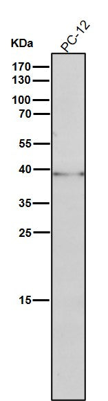 All lanes use the Antibody at 1:1K dilution for 1 hour at room temperature.