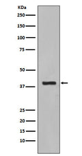 Anti-Cytokeratin 19 KRT19 Rabbit Monoclonal Antibody