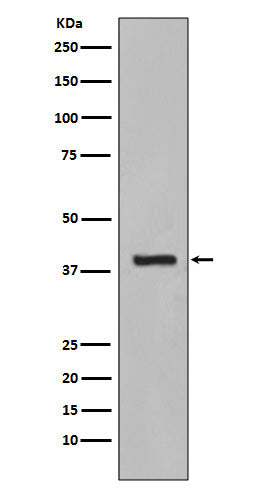 Anti-Cytokeratin 19 KRT19 Rabbit Monoclonal Antibody