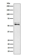 Western blot analysis of Angiotensinogen expression in Human plasma lysate.