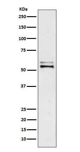 Western blot analysis of Angiotensinogen expression in Human plasma lysate.