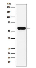 Western blot analysis of Angiotensinogen expression in HepG2 cell lysate.
