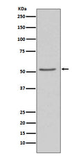 Western blot analysis of Angiotensinogen expression in 293T cell lysate.