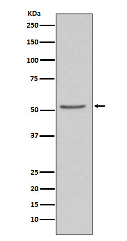 Western blot analysis of Angiotensinogen expression in 293T cell lysate.