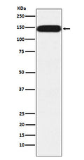 Western blot analysis of Pumilio 1 expression in HeLa cell lysate.