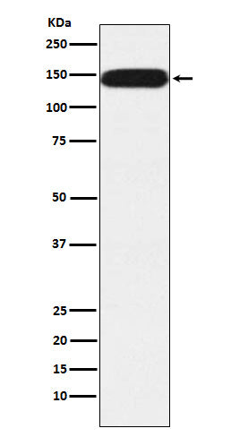 Western blot analysis of Pumilio 1 expression in HeLa cell lysate.