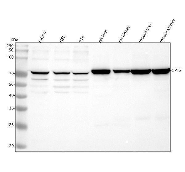 Anti-CPT2 Rabbit Monoclonal Antibody
