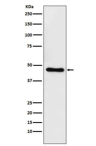 Western blot analysis of CtBP1 expression in Raji cell lysate.