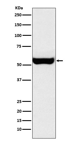 Western blot analysis of Monoamine Oxidase B expression in SH-SY5Y cell lysate.