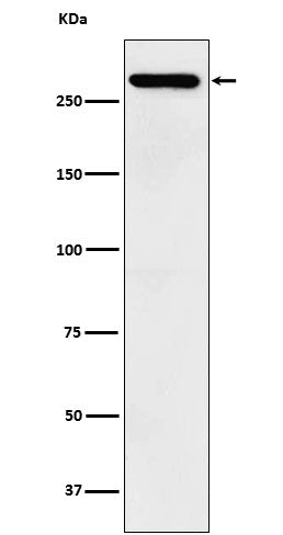 Western blot analysis of TAF1 expression in SH-SY5Y cell lysate.
