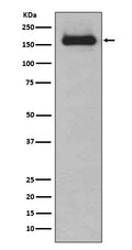 Western blot analysis of HDAC9 expression in K562 cell lysate.