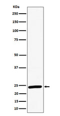 Western blot analysis of RAB8A expression in HeLa cell lysate.