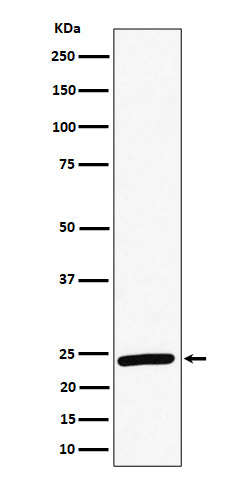 Western blot analysis of RAB8A expression in HeLa cell lysate.