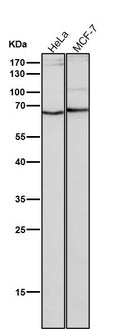All lanes use the Antibody at 1:1W dilution for 1 hour at room temperature.