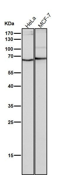 All lanes use the Antibody at 1:1W dilution for 1 hour at room temperature.