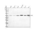 Anti-ARRB1/Beta Arrestin 1 Rabbit Monoclonal Antibody