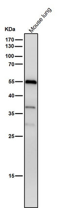All lanes use the Antibody at 1:1W dilution for 1 hour at room temperature.