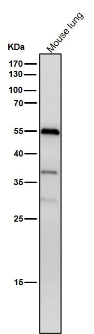 All lanes use the Antibody at 1:1W dilution for 1 hour at room temperature.
