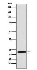 Western blot analysis of Proteasome 20S LMP7 expression in U937 cell lysate.