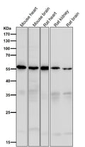 All lanes use the Antibody at 1:1K dilution for 1 hour at room temperature.