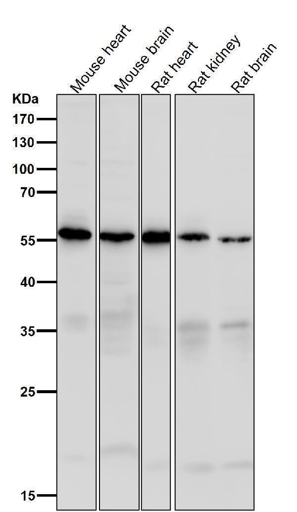 All lanes use the Antibody at 1:1K dilution for 1 hour at room temperature.