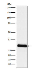 Western blot analysis of ApoD expression in Human plasma lysate.
