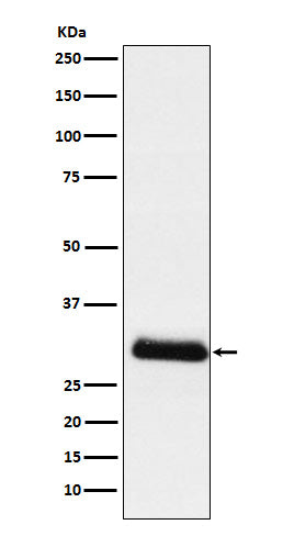 Western blot analysis of ApoD expression in Human plasma lysate.