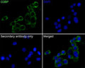 Immunocytochemistry analysis of N2A cells, using G3BP antibody.