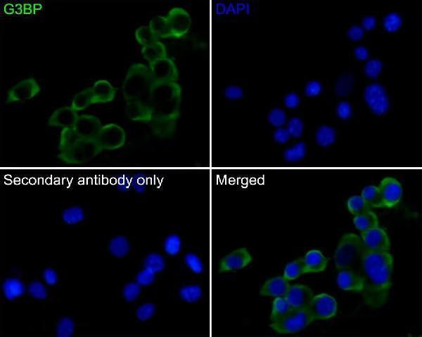 Immunocytochemistry analysis of N2A cells, using G3BP antibody.