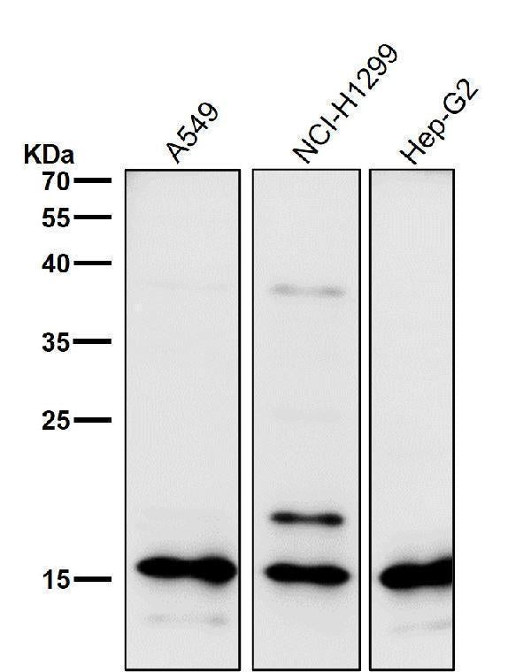 All lanes use the Antibody at 1:2K dilution for 1 hour at room temperature.