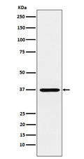 Western blot analysis of CRX expression in Y79 cell lysate.