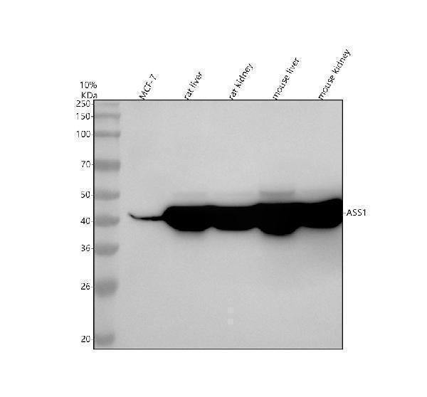 Anti-ASS1 Rabbit Monoclonal Antibody