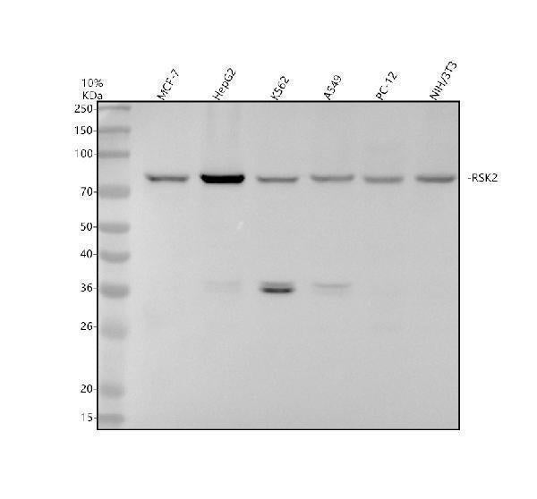 Anti-RSK2 / RPS6KA3 Rabbit Monoclonal Antibody