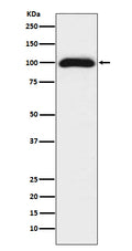 Western blot analysis of CD276 expression in 293T cell lysate.