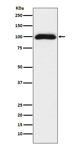 Western blot analysis of CD276 expression in 293T cell lysate.