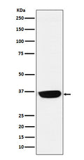 Western blot analysis of PHOX2B expression in Neuro-2a cell lysate.