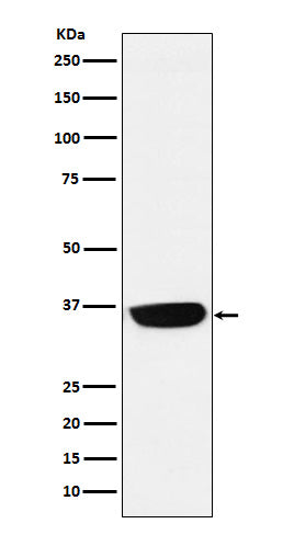 Western blot analysis of PHOX2B expression in Neuro-2a cell lysate.