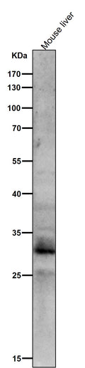 All lanes use the Antibody at 1:1K dilution for 1 hour at room temperature.
