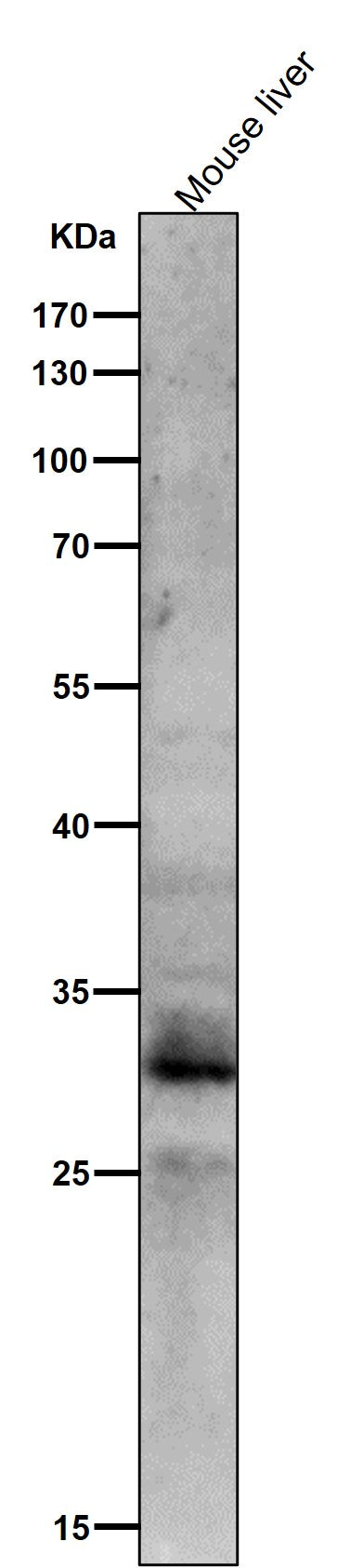All lanes use the Antibody at 1:1K dilution for 1 hour at room temperature.