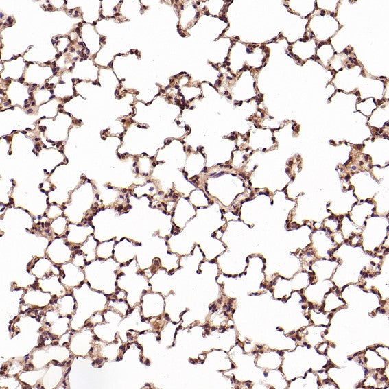 Anti-CD8 alpha Rabbit Monoclonal Antibody