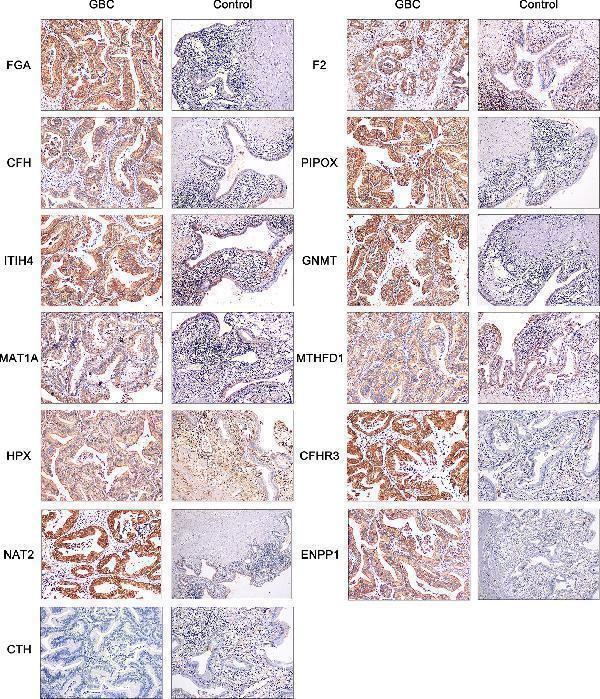 Anti-Hemopexin HPX Monoclonal Antibody