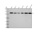 Anti-HIP1 Monoclonal Antibody