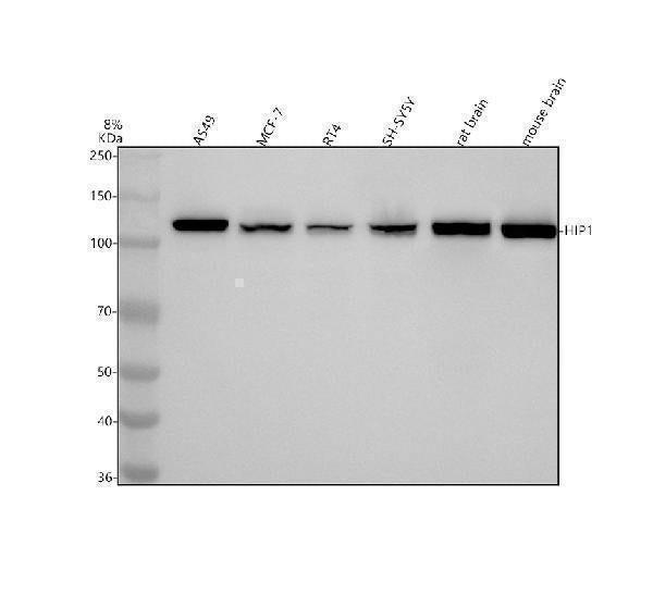 Anti-HIP1 Monoclonal Antibody