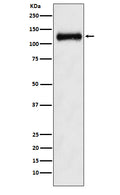 Western blot analysis of ANPRB expression in Human fetal kidney lysate.
