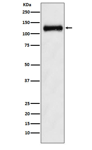 Western blot analysis of ANPRB expression in Human fetal kidney lysate.