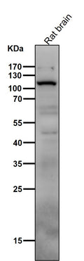 All lanes use the Antibody at 1:1K dilution for 1 hour at room temperature.