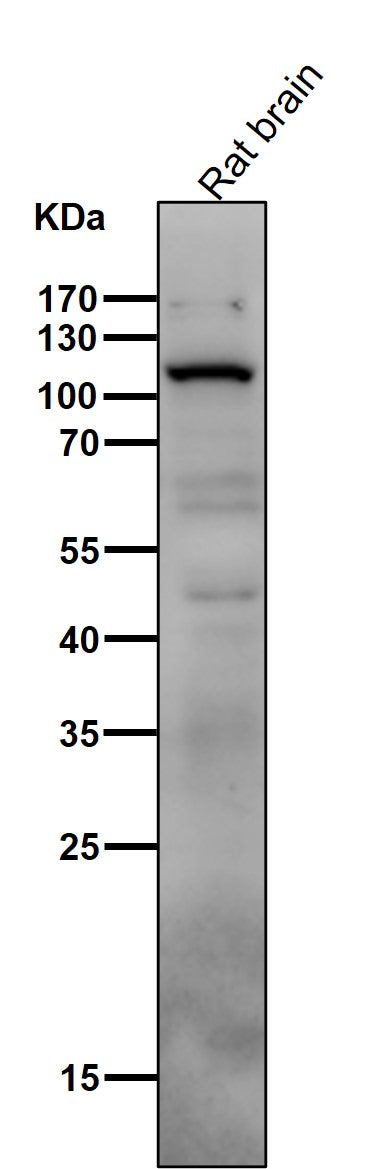 All lanes use the Antibody at 1:1K dilution for 1 hour at room temperature.