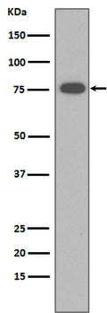 Western blot analysis of Vitronectin expression in human Serum membrane lysate.