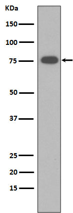Western blot analysis of Vitronectin expression in human Serum membrane lysate.
