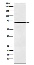 Western blot analysis of LOX12 expression in A431 cell lysate.